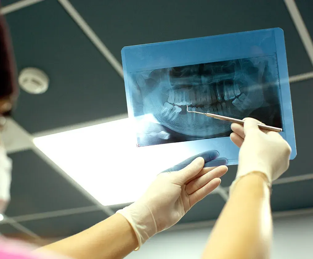 A clinician holding a panoramic jaw X-ray up to the light and pointing out the bone in the lower jaw